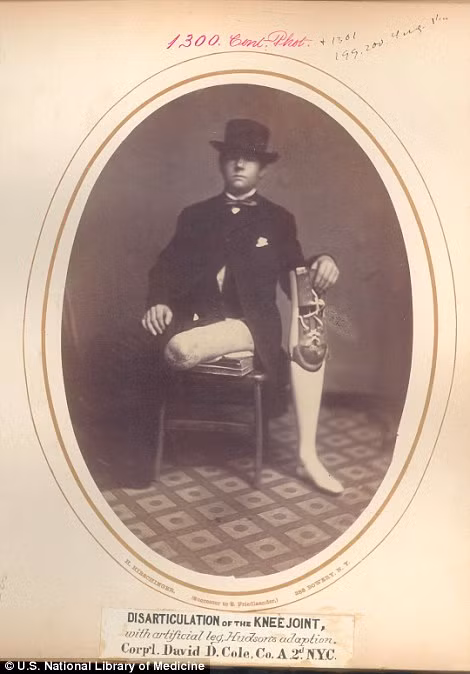 Tướng David D. Cole đã phải trải qua phẫu thuật cắt cụt chân, tháo khớp gối trong trận Amelia Courthouse.