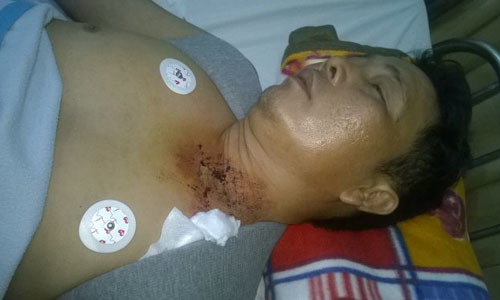 Ông Phạm Văn Bông tại bệnh viện.