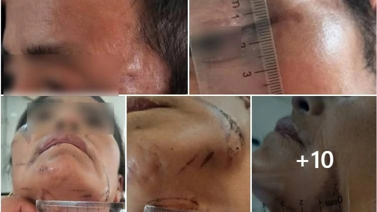 Thông tin mới vụ bắt giữ người trái pháp luật vì nghi bị bỏ bùa Thong tin moi vu bat giu nguoi trai phap luat vi nghi bi bo bua