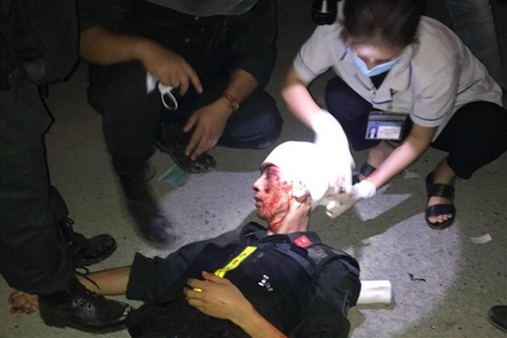 Bao ve thiet bi dien gio, nhieu cong an bi danh: Khoi to vu an