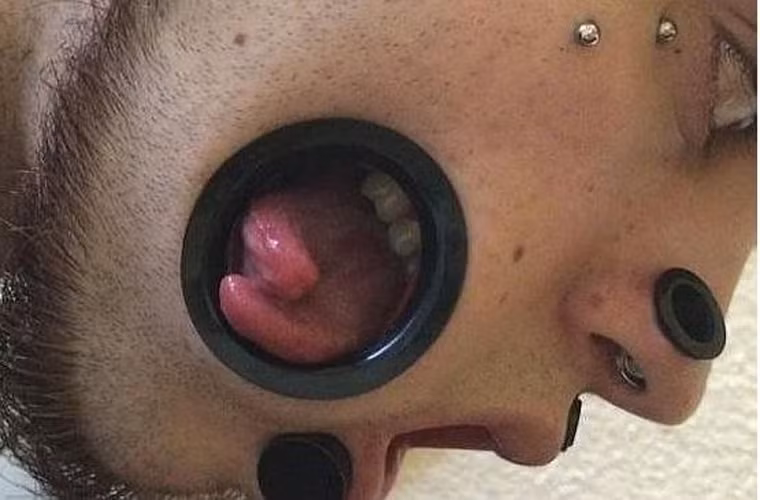 Chẻ lưỡi, thò qua má. Hình ảnh chiếc lưỡi kép này thuộc về chàng trai Joel Miggler (23 tuổi, Đức). Miggler đã tạo ra những lỗ hổng lớn ở hai bên má mà từ đó người ta có thể nhìn thấy răng của mình. Thậm chí, lưỡi của anh còn thập thò ở đây.