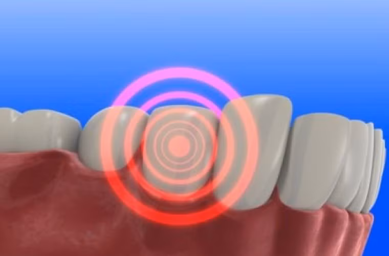 Một nghiên cứu chỉ ra mối liên hệ giữa yếu tố vệ sinh răng miệng kém với việc nhiễm virus HPV gây ung thư nguy hiểm.