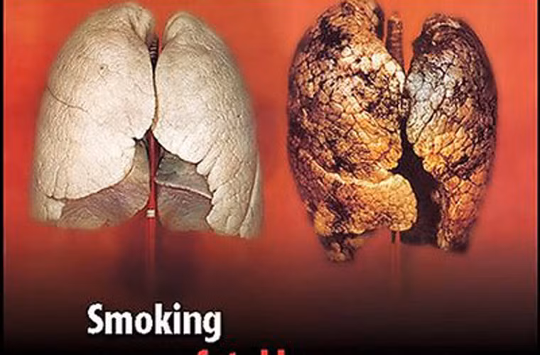 Họ cũng nói thêm rằng thu nhập bình quân thấp có liên quan đến bệnh ung thư phổi và ung thư cổ tử cung. Điều này bắt nguồn từ việc những người gặp khó khăn tài chính thường có thói quen nghiện thuốc lá và ít tham gia xét nghiệm phết tế bào phát hiện bệnh.