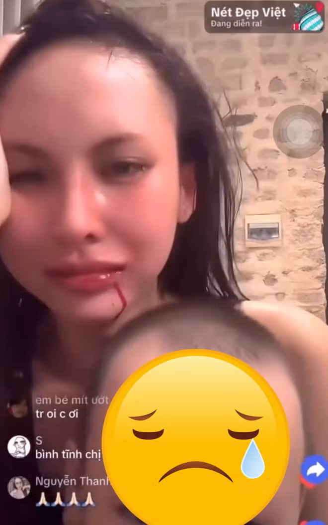 3 lần Decao sát thương Lâm Minh - Hình 4 3 lan Decao sat thuong Lam Minh-Hinh-4