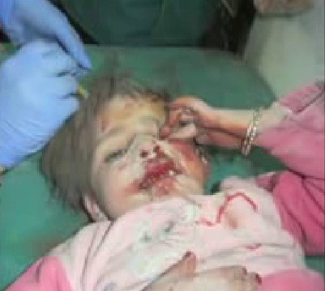 Một em bé Syria - nạn nhân của các tay súng bắn tỉa máu lạnh.