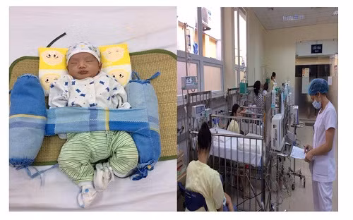 Hiện tình trạng trẻ đã ổn định. Ảnh: BV Nhi TƯ