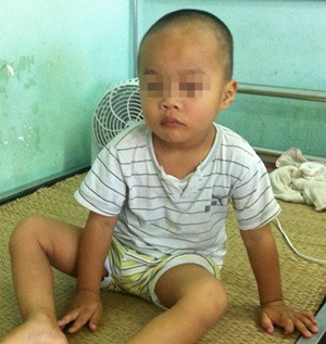 Hiện bệnh nhi đã được ra viện với tình trạng sức khỏe ổn định. Ảnh: BVCC