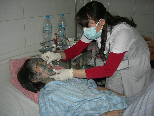 Thủy đậu là bệnh truyền nhiễm dễ lây lan, hầu hết bệnh ở mức độ nhẹ. Tuy nhiên nếu như không kịp thời phát hiện, cách ly các trường hợp mắc bệnh thì vi rút sẽ rất dễ phát tán và lây sang người khác qua dịch miệng, mắt, mũi. Hiện đã cung cấp đủ vắc xin thủy đậu cho các cơ sở tiêm chủng.