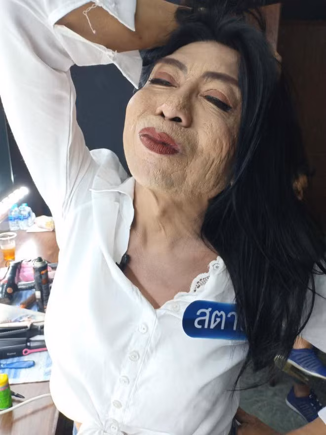 “Thục nữ Thái Lan” đi tân trang da mặt nhưng cái kết sốc “Thuc nu Thai Lan” di tan trang da mat nhung cai ket soc