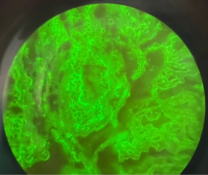 Dieu tri thanh cong ca benh da hiem gap thu 10 tren the gioi-Hinh-2