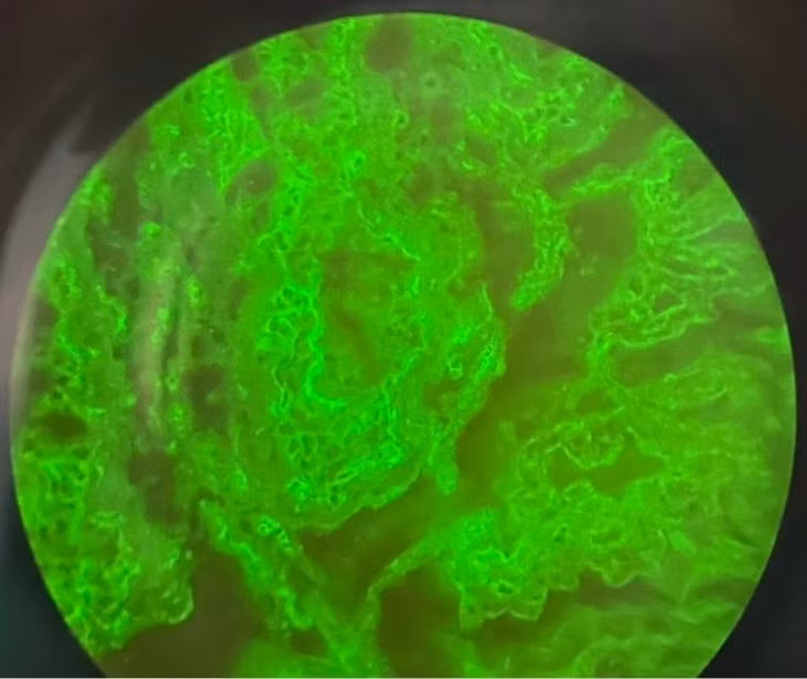 Dieu tri thanh cong ca benh da hiem gap thu 10 tren the gioi-Hinh-2