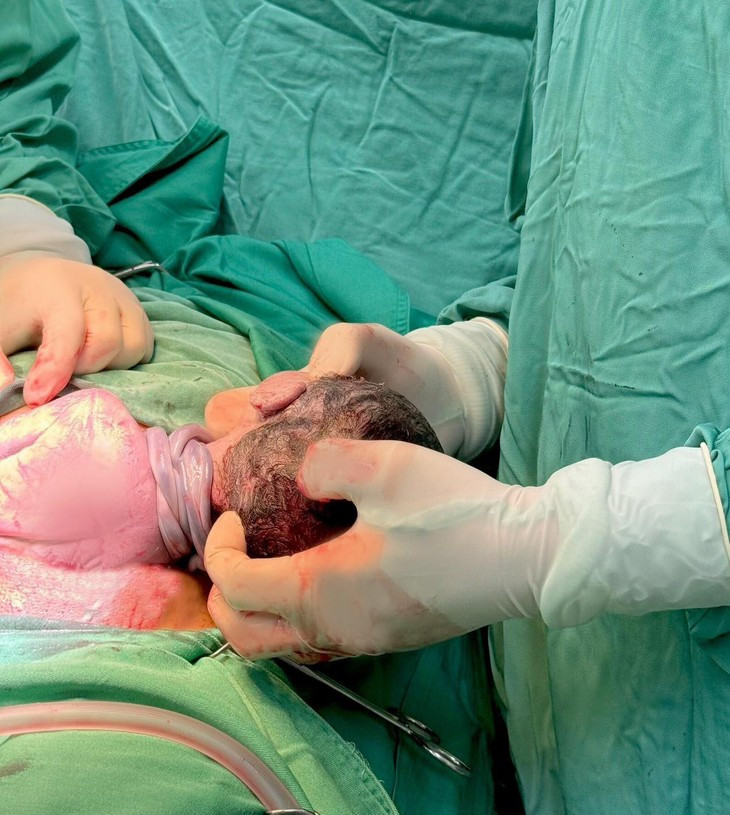 Cap song sinh: Mot day ron that nut, mot 3 vong rau quan co-Hinh-2