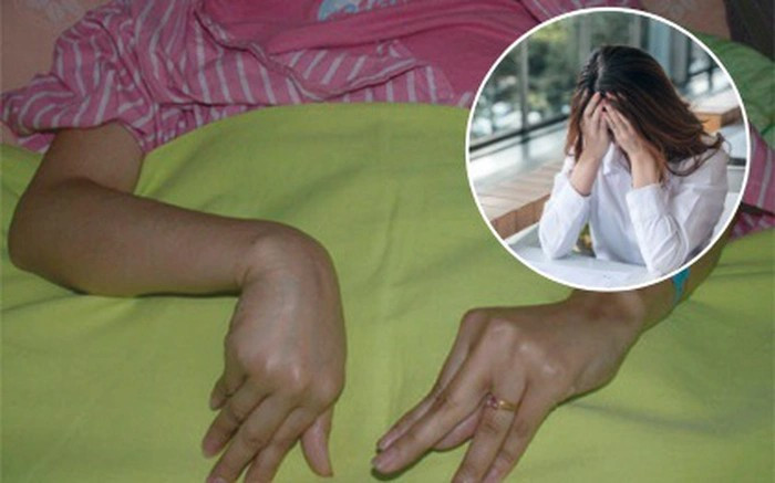 Bien chung nguy hiem khi ha canxi mau va cach phong tranh-Hinh-2