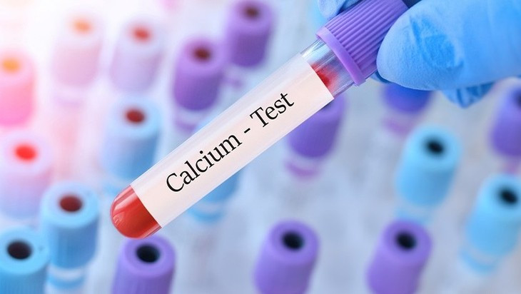 Bien chung nguy hiem khi ha canxi mau va cach phong tranh