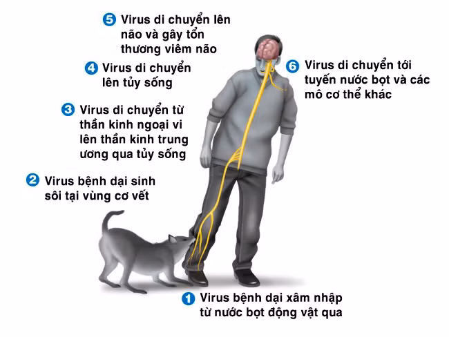 Benh dai bung phat, biet cach xu ly de tranh tu vong-Hinh-2