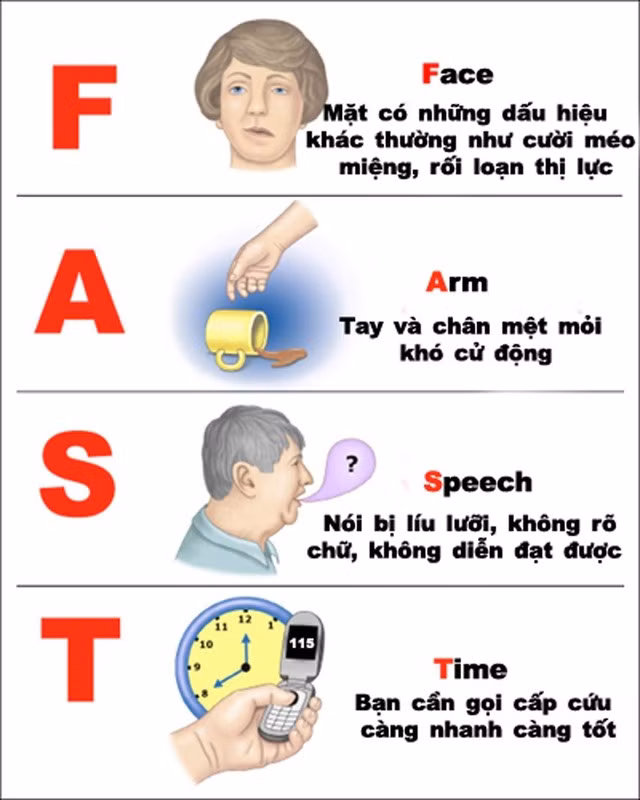 Bac si khuyen 6 dieu nen lam, 3 dieu tranh voi benh nhan dot quy-Hinh-2