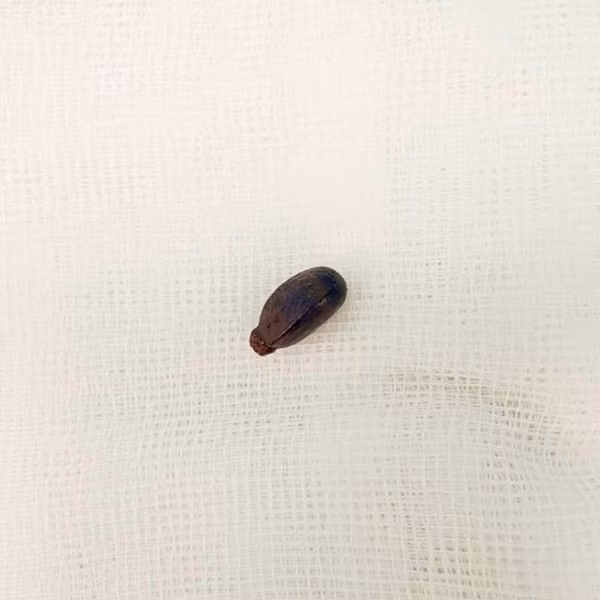 Be 14 thang tuoi bi bien chung phoi do hoc hat mang cau-Hinh-2