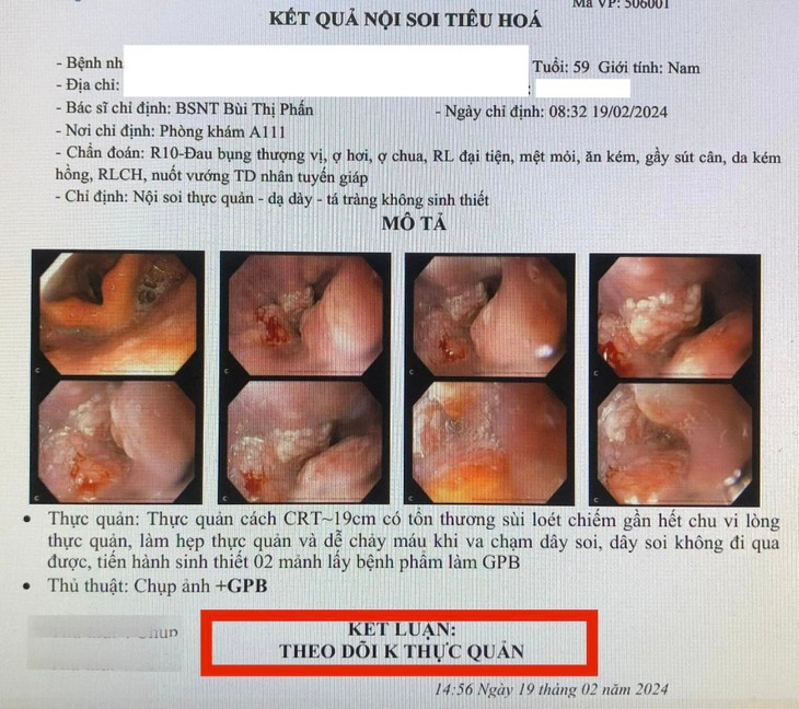 Nguoi dan ong nuot nghen, noi hach co, di kham phat hien ung thu