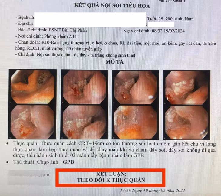 Nguoi dan ong nuot nghen, noi hach co, di kham phat hien ung thu