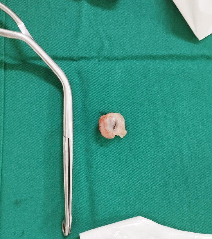 Be gai 5 tuoi suy ho hap nguy kich vi hoc qua nhan-Hinh-2