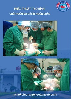 Phau thuat chuyen ngon chan len tai tao ngon tay cai bi cut-Hinh-2