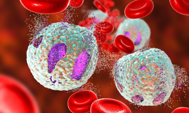 Trieu chung cua benh ung thu mau ac tinh va cach phong ngua