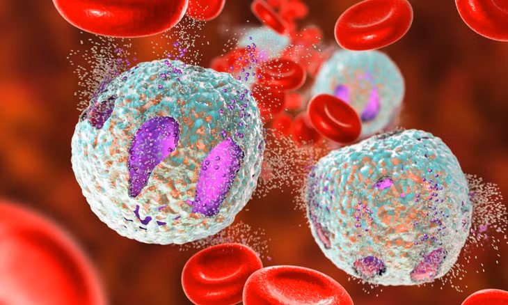 Trieu chung cua benh ung thu mau ac tinh va cach phong ngua