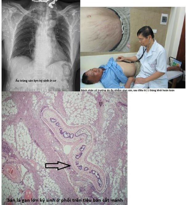 GS.TS Nguyen Van De 40 nam “dam me” voi ky sinh trung-Hinh-2