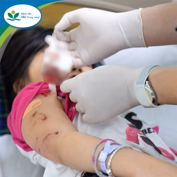 Cach so cuu khi tre bi cho can, tranh hau qua dang tiec