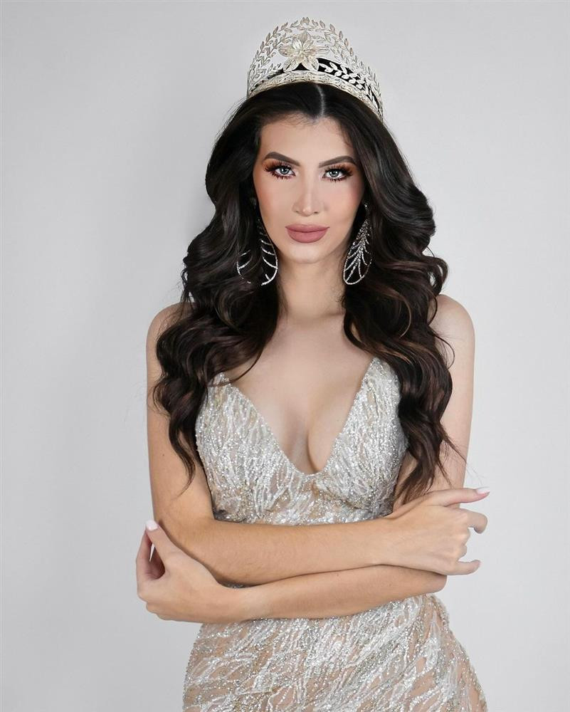 ại diện Paraguay - Jimena Sosa - có gần 36.000 người theo dõi. Người đẹp năm nay 21 tuổi, cao 1,75 m. Cô là người mẫu chuyên nghiệp, có thể nói được tiếng Anh và Tây Ban Nha. Jimena Sosa từng đại diện Paraguay tham dự Hoa hậu Hòa bình Quốc tế 2021 nhưng không giành thành tích.