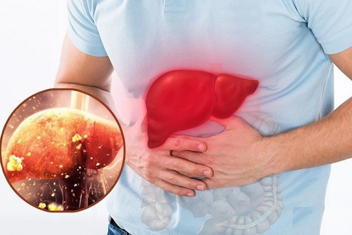 5 thoi quen tan pha gan vao mua lanh