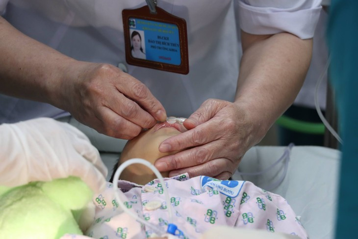 Be 3 tuoi bi ung thu am dao: Cach phat hien va phong ngua-Hinh-3