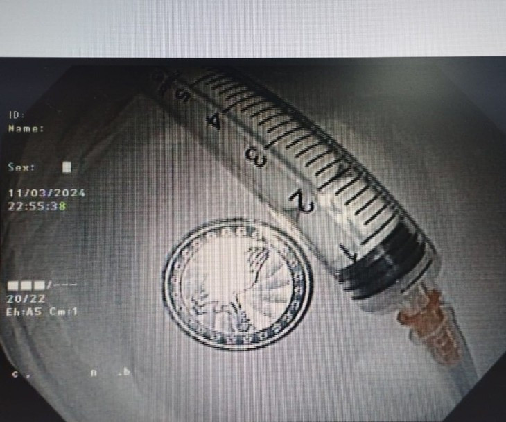 Gap thanh cong dong xu ra khoi thuc quan be 6 tuoi-Hinh-2