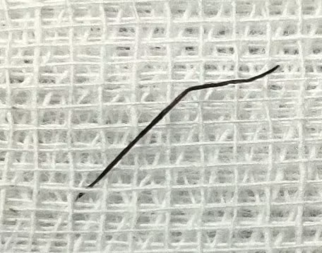 Co gai thung ruot non vi nuot phai ghim ho so dai 2 cm