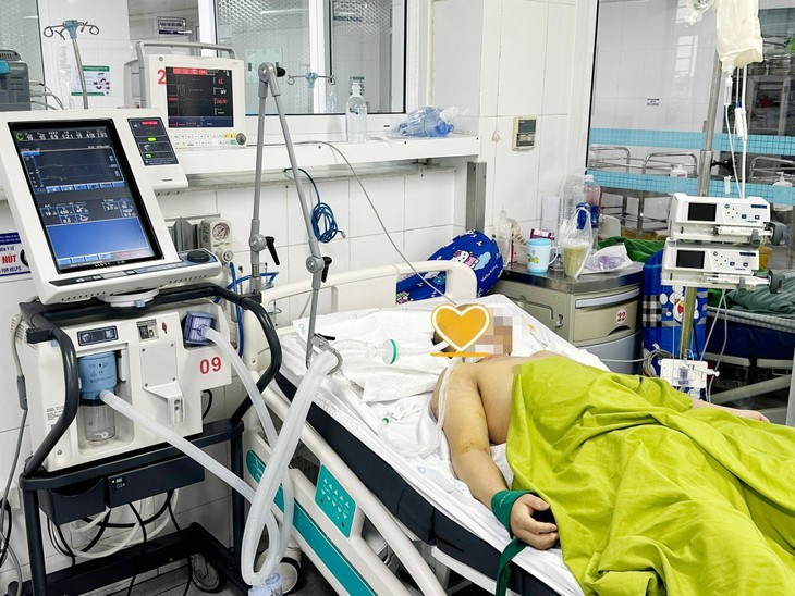 Bac si chi dau hieu va cach xu tri khi bi soc nhiet