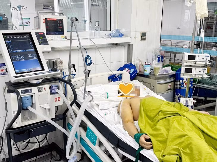 Bac si chi dau hieu va cach xu tri khi bi soc nhiet