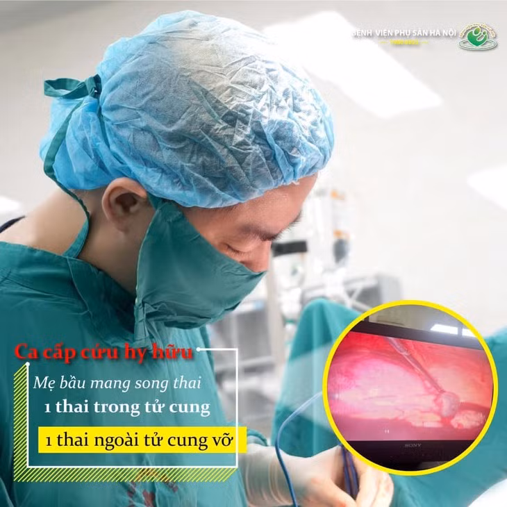 Cuu thai phu mang 1 thai trong tu cung, 1 thai ngoai tu cung vo