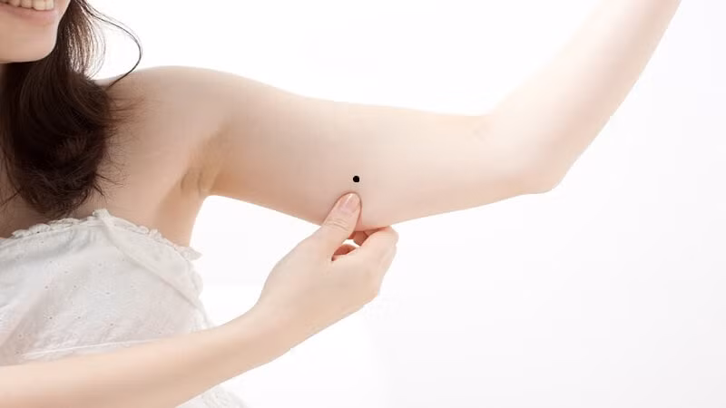 Co not ruoi may man nay tren co the, ca doi phu quy