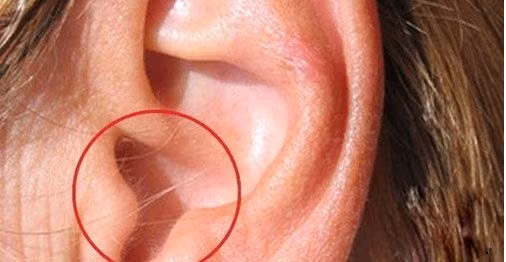 Họ là người thông minh, lanh lợi ngay từ khi sinh ra, biết nhìn xa trông rộng, nắm bắt thời cơ nên không sớm thì muộn, sự nghiệp cũng thành công rực rỡ. Không kể là nam hay nữ, những người có lông trong tai đều có thành tựu trong sự nghiệp từ khá sớm. 