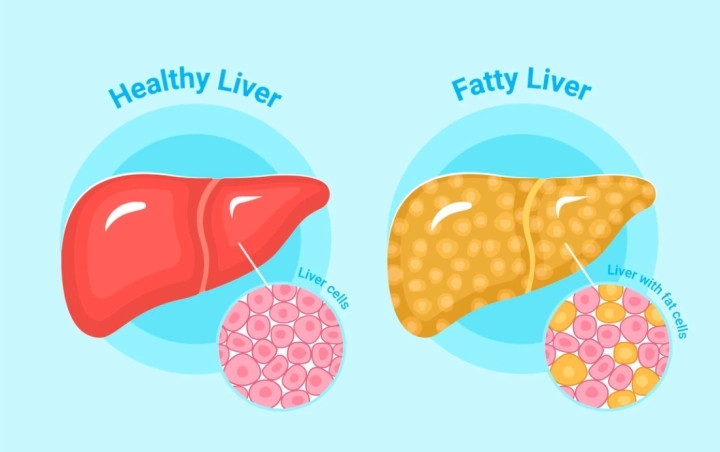 Nhung hanh vi lam hong gan nhanh nhat, ban nen biet de tranh