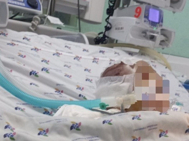 Vu be 6 thang tuoi bi danh dap nao: Nan nhan thuong tich 99%