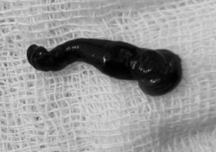 Gap con dia chui trong hoc mui chau be nguoi Mong