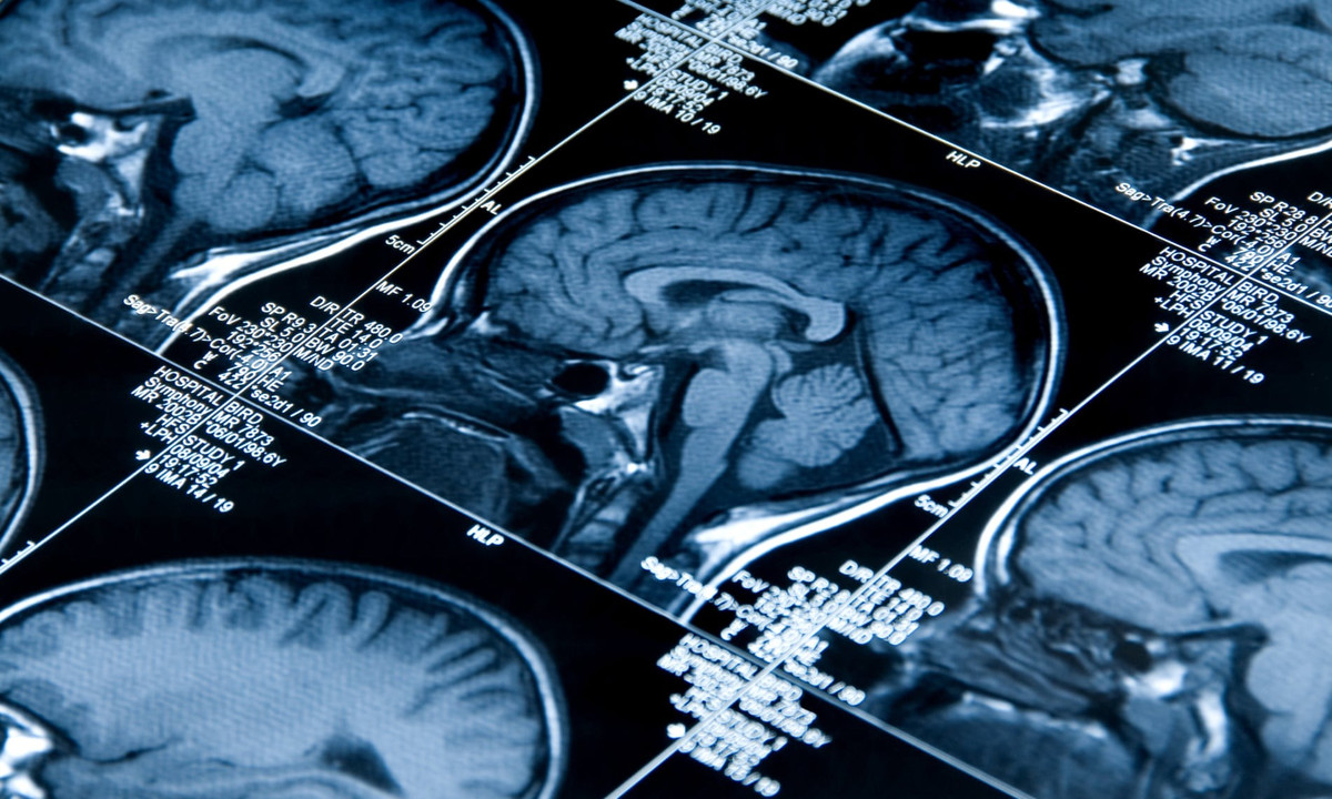 Nghien cuu gay tranh cai “hoi cu dem” co chuc nang nhan thuc cao hon?-Hinh-3