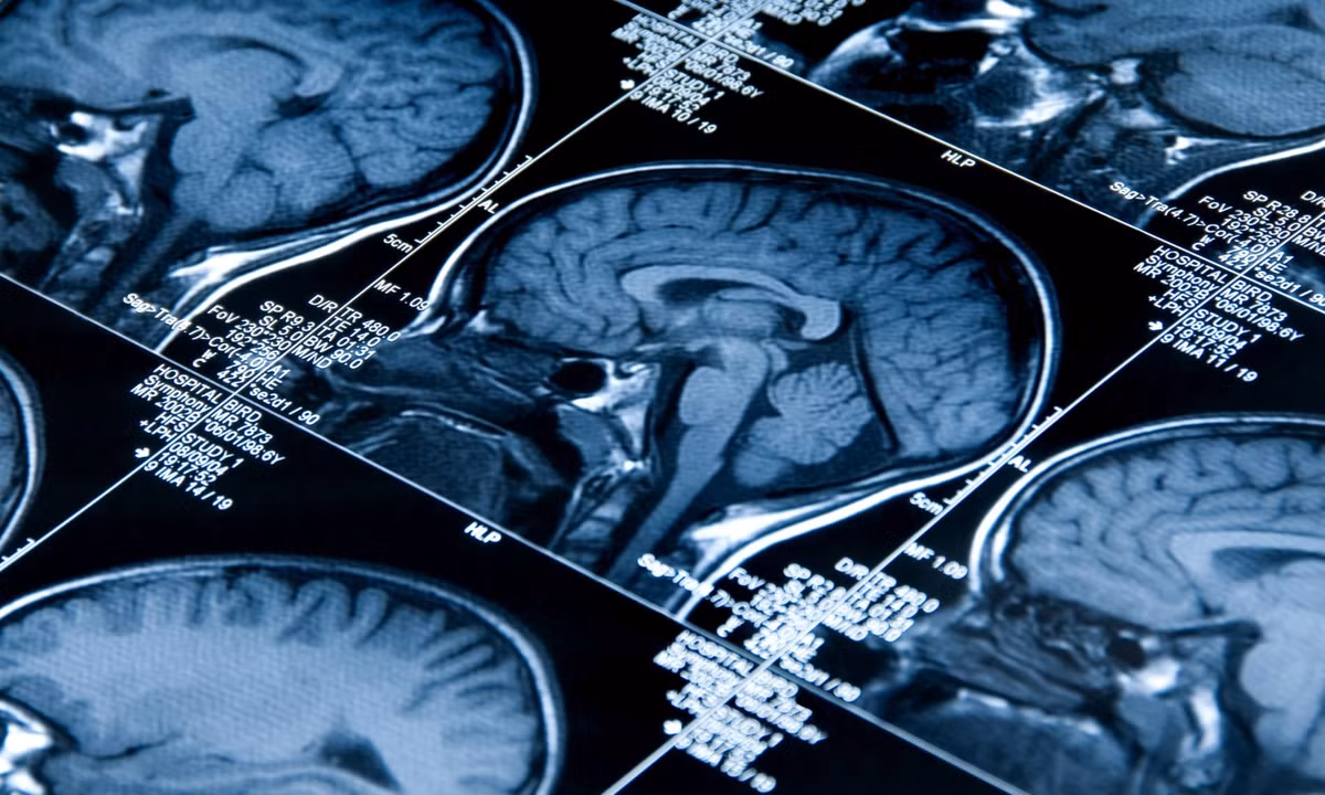 Nghiên cứu gây tranh cãi “hội cú đêm” có chức năng nhận thức cao hơn? - Hình 3 Nghien cuu gay tranh cai “hoi cu dem” co chuc nang nhan thuc cao hon?-Hinh-3