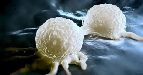 Muon nhan biet ung thu, kiem tra dau hieu tai 3 thoi diem