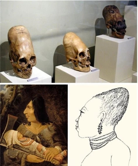  2. Xăm hình mỉm cười ở Nhật Bản: Hình xăm mỉm cười của người Ainu. Người Ainu sống trên một số đảo ở Nhật Bản và Nga. Phụ nữ xăm khuôn mặt để có một cái gì đó giống như nụ cười. Để thay đổi hình dạng của xương sọ, cha mẹ phải băng đầu đứa trẻ bằng một dải băng hoặc đặt bé vào một cái nôi đặc biệt. 