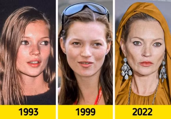 Vẻ đẹp sẽ thay đổi theo thời gian, với người nổi tiếng cũng không nằm ngoài quy luật này. Trước khi nổi tiếng, nhiều người trong số họ trông như phần đa các cô gái tuổi teen khác và thậm chí không mấy nổi bật. Ngôi sao Hollywood thời chưa nổi tiếng: Kate Moss.