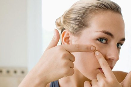 Sờ, nặn mụn. Đôi bàn tay thường có nhiều vi khuẩn bám vào, nếu sờ lên mụn sẽ làm mụn sưng tấy và mọc nhiều thêm. Ngoài ra, một số người cho rằng, nếu nặng mụn sẽ chóng khỏi. Thực ra, khi mụn chưa chín, thay vì việc lấy được cặn bã ra ngoài, cặn bã sẽ ấn xuống sâu hơn, làm mụn sưng tấy, gây nhiễm trùng. Nặn mụn sớm còn để lại vết thăm sâu hơn và dễ để lại sẹo.