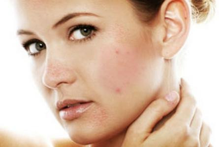 Tránh chạm tay vào mặt. Nhiều bạn gái có thói quen chống cằm khi ngồi vào bàn làm việc, hay ôm mặt lúc mệt mỏi hoặc thường áp sát điện thoại vào mặt. Những lúc như vậy, hàng tá vi khuẩn trên đôi tay sẽ được đưa lên mặt. Đó chính là cách dễ dàng nhất giúp cho "kẻ địch" xuất hiện trên mặt bạn.