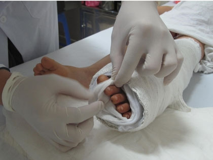 Nghĩa là sau khi ghép nối, phần cơ thể sẽ “hòa nhập” với cơ thể giống gần như ban đầu, kể cả những phần cần nhiều máu để nuôi.